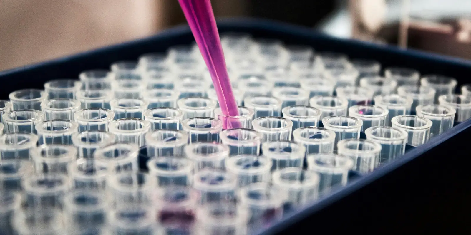 estudo-mostra-que-inflamacao-no-cerebro-pode-ser-chave-do-alzheimer