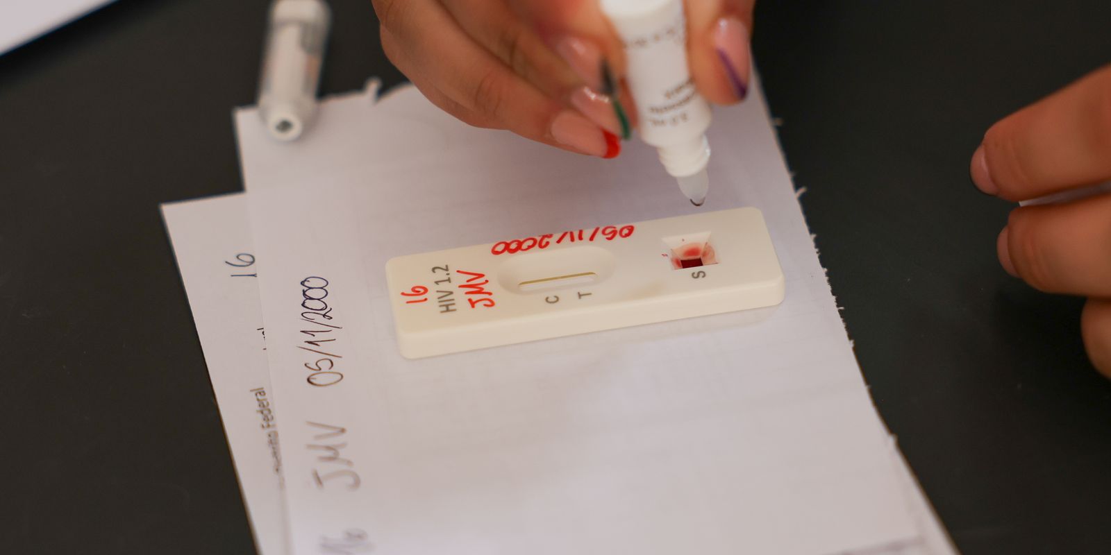 acao-no-df-oferece-testagem-rapida-e-informacao-sobre-hiv/aids