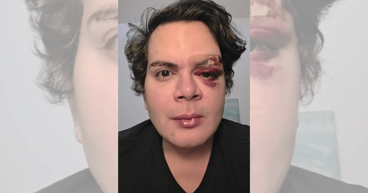medico-denuncia-agressao-e-homofobia-no-proprio-apartamento-no-recife