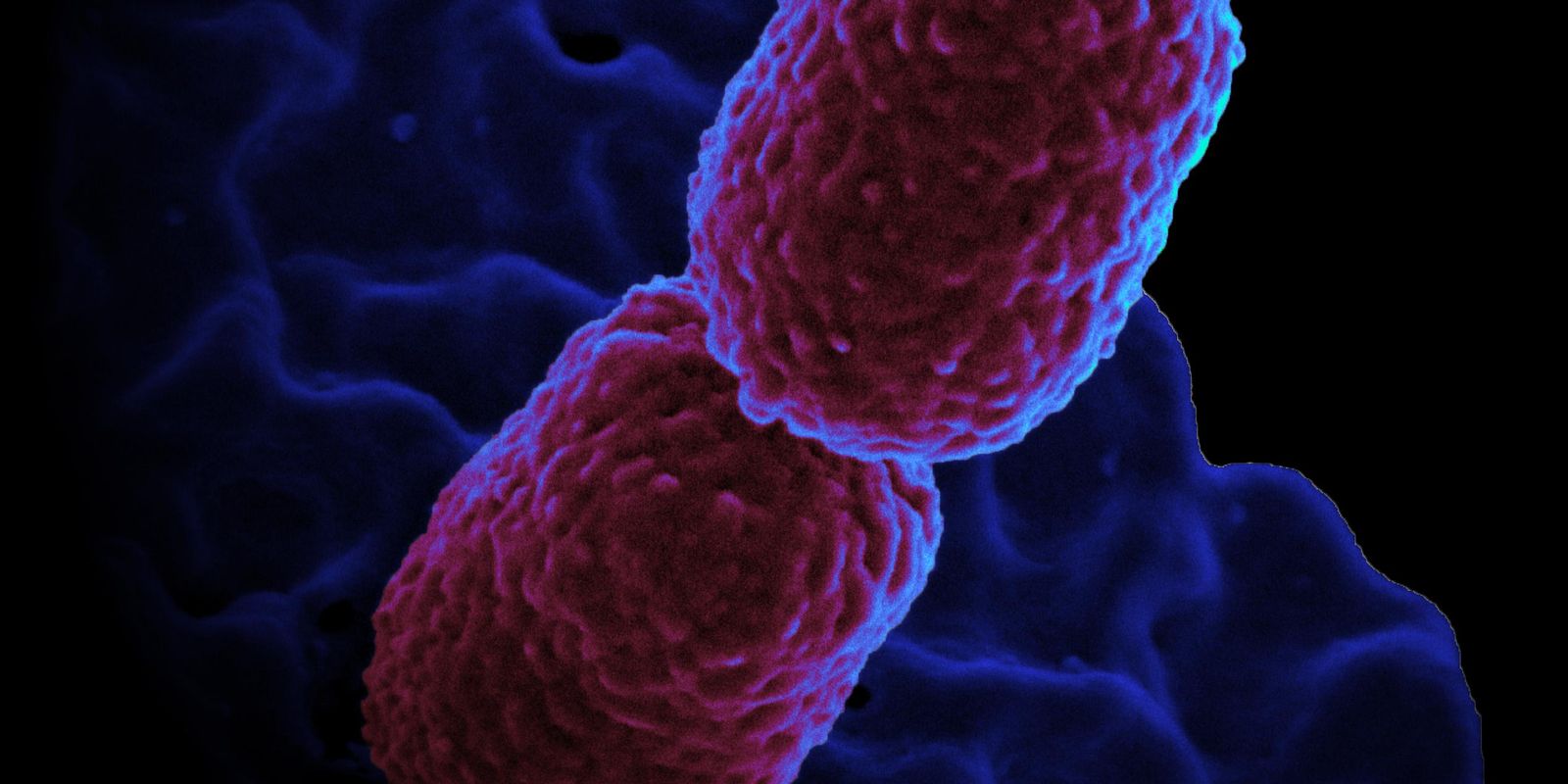 hospital-em-campinas-restringe-atendimento-para-conter-superbacteria
