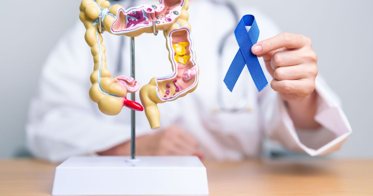 obesidade-na-adolescencia-eleva-risco-de-cancer-precoce-de-intestino